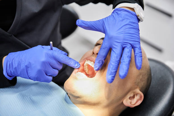 Best Dentist for Dental Trauma  in Burwell, NE